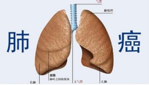 EGFR突变的靶向药AZD9291耐药机制你知道吗