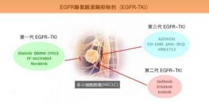 肺癌靶向药物泰瑞沙（AZD9291）获中国CFDA批准